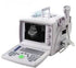 US9618 Portable Ultrasound Scanner with Convex Probe